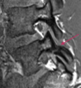 Lannerangan poikkileikkaus 1
