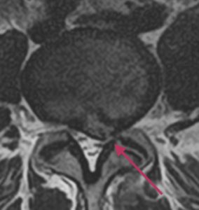 Lannerangan poikkileikkaus 2