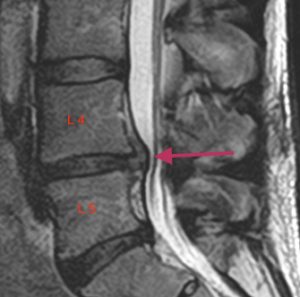 Lannerangan magneettikuva 2